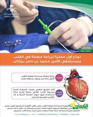 نجاح أول عملية لزراعة مضخة قلب في مستشفى الأمير محمد بن ناصر .
