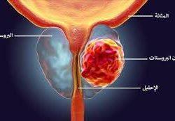 أمير تبوك يؤكد على أهمية الدور المناط بالمحافظين في نقل الصورة الحقيقية التي يشعر بها المواطن والمواطنة وتلمس احتياجاتهم وخدمتهم