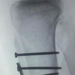 كاس السوبر الفرنسي يعيد أشرف حكيمي مع نخبة النجوم – نفاد الدفعة الأولى من التذاكر وطرح دفعة ثانية بسعر 30 ريالاً