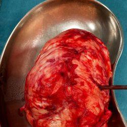 تعليم الطائف يدعو الطلبة والمعلمين وأولياء الأمور للتسجيل في البرنامج الوزاري ( بيئة مدرستي أجمل )