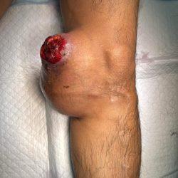 مستشفى الملك عبدالعزيز يشارك بفعالية “امشي ٣٠”بكورنيش الحمراء ويقيم الفعالية بحديقة الأمير ماجد لتعزيز الوعي الصحي