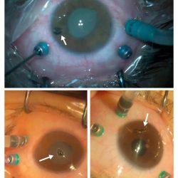 العنزى يشكر الكشافة الإسلامية الجزائرية