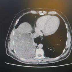 نادي جدة الأدبي تحوَّل الى جمعية.. واعتماد مجلس الادارة برئاسة السلمي
